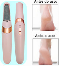 Lima Removedor Electrico, removedora de callos, portátil, recargable, exfoliante para pedicura.